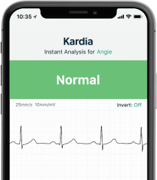 ECG Anywhere, Anytime